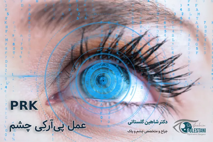 عمل پی آر کی در مشهد
