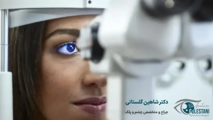 متخصص چشم در مشهد