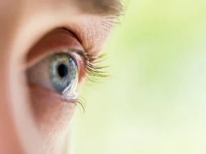 بازگشت بینایی بعد از عمل کاتاراکت
