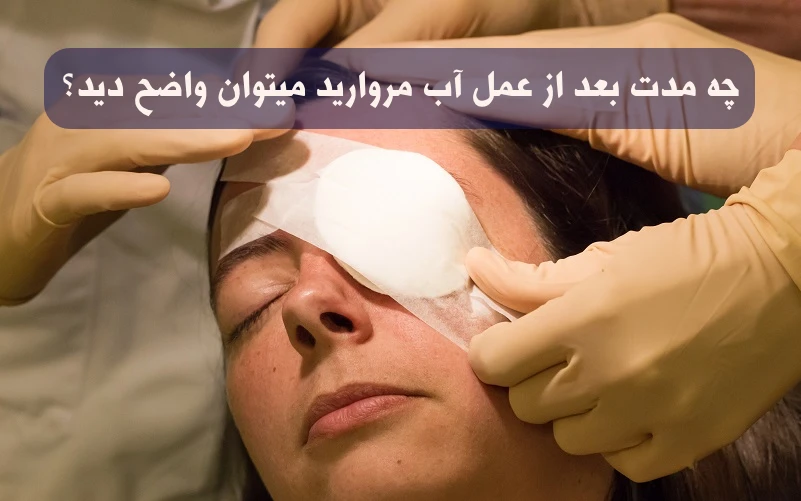 بازیابی بینایی بعد از عمل آب مروارید