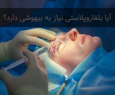 بلفاروپلاستی با بیحسی و بیهوشی