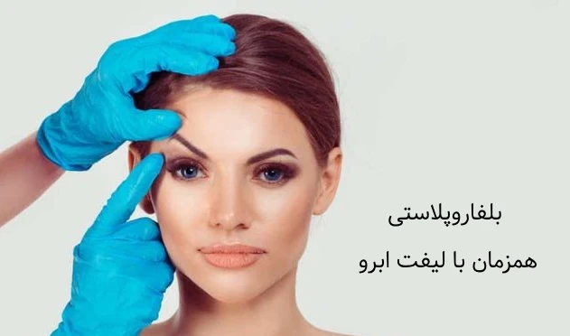 بلفاروپلاستی همزمان با لیفت ابرو