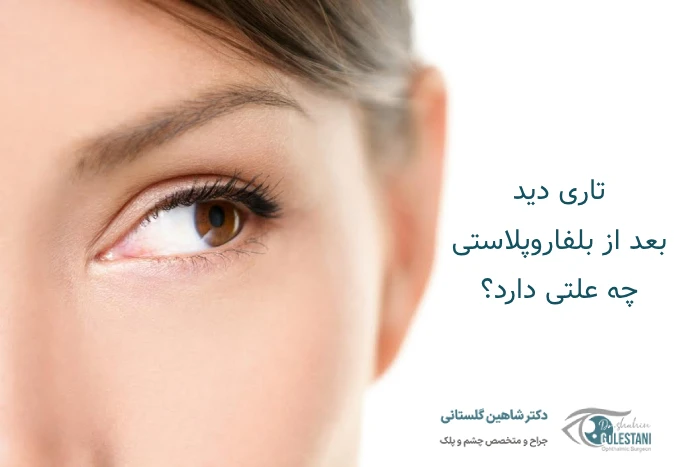تاری دید بعد از بلفاروپلاستی