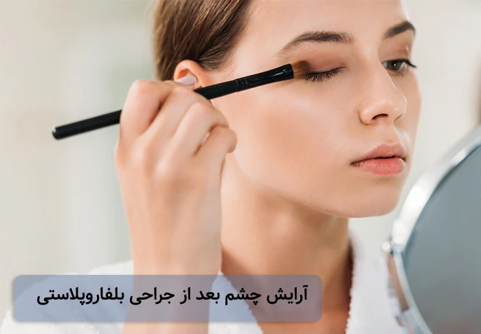 آرایش بعد از بلفاروپلاستی