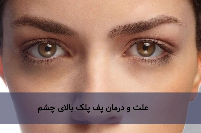 درمان پف بالای پلک