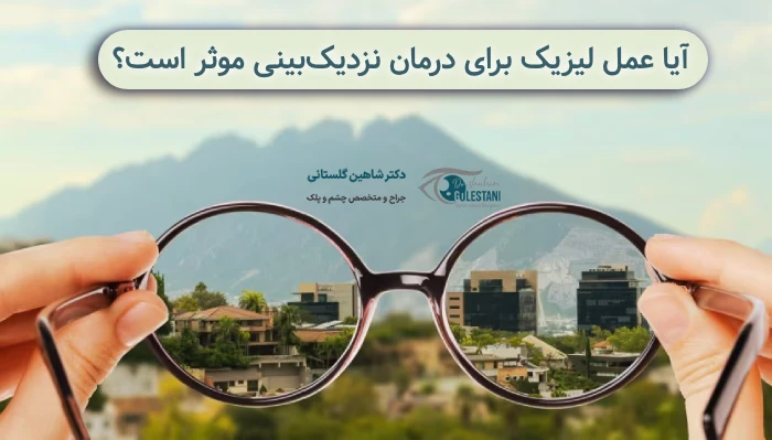 عمل لیزیک چشم برای نزدیک بینی