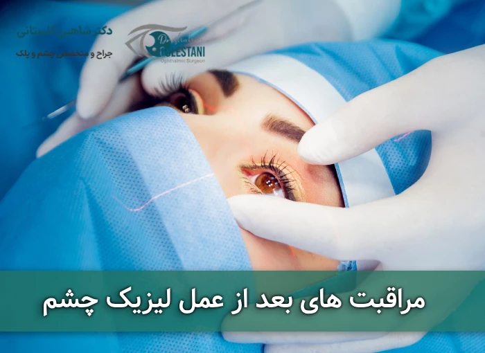 مراقبت های بعد از عمل لیزیک چشم