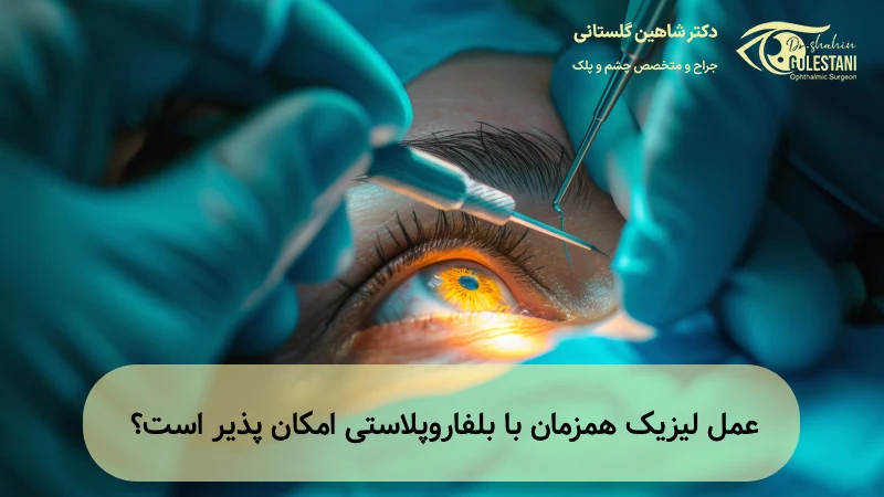 بلفاروپلاستی همزمان با عمل لیزیک