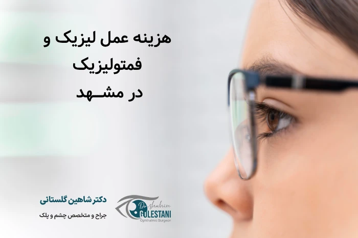 هزینه عمل لیزیک در مشهد